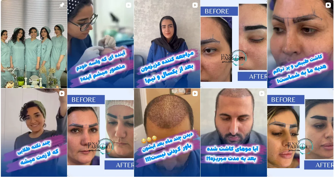 پست های اینستاگرام الناز فرخ