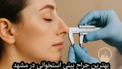 بهترین جراح بینی استخوانی در مشهد