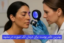 بهترین دکتر پوست برای درمان لک صورت در مشهد
