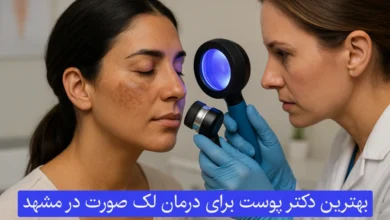 بهترین دکتر پوست برای درمان لک صورت در مشهد